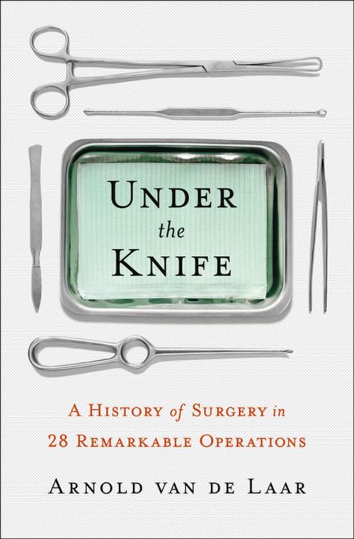 Cover of the book Under the Knife by Arnold van de Laar, Laproscopic surgeon, St. Martin's Press