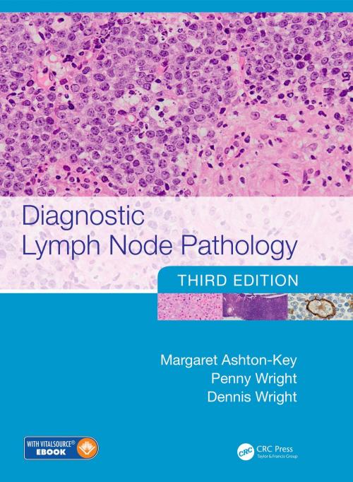Cover of the book Diagnostic Lymph Node Pathology by Margaret Ashton-Key, Penny Wright, Dennis Wright, CRC Press