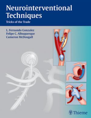 Cover of the book Neurointerventional Techniques by Nikolaus A. Haas, Ulrich Kleideiter