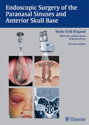 Cover of the book Endoscopic Surgery of the Paranasal Sinuses and Anterior Skull Base by Kartik G. Krishnan