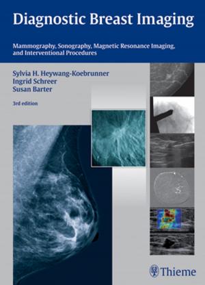 Cover of the book Diagnostic Breast Imaging by David Goldenberg, Bradley J. Goldstein