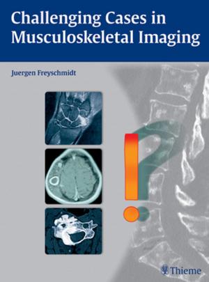 Cover of the book Challenging Cases in Musculoskeletal Imaging by 