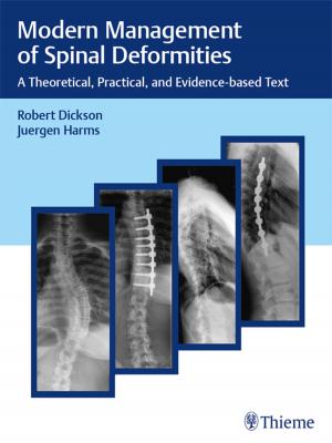 Cover of Modern Management of Spinal Deformities