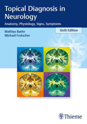 Book cover of Topical Diagnosis in Neurology
