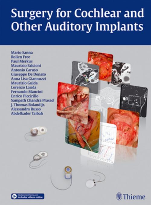 Cover of the book Surgery for Cochlear and Other Auditory Implants by Mario Sanna, Rolien Free, Paul Merkus, Thieme