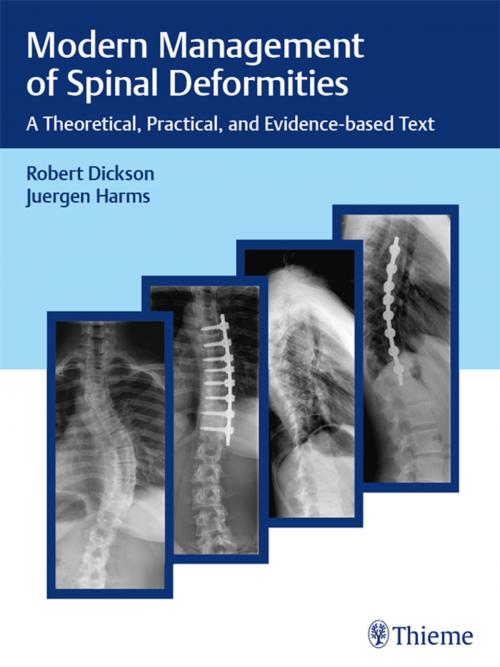 Cover of the book Modern Management of Spinal Deformities by Robert A. Dickson, Juergen Harms, Thieme