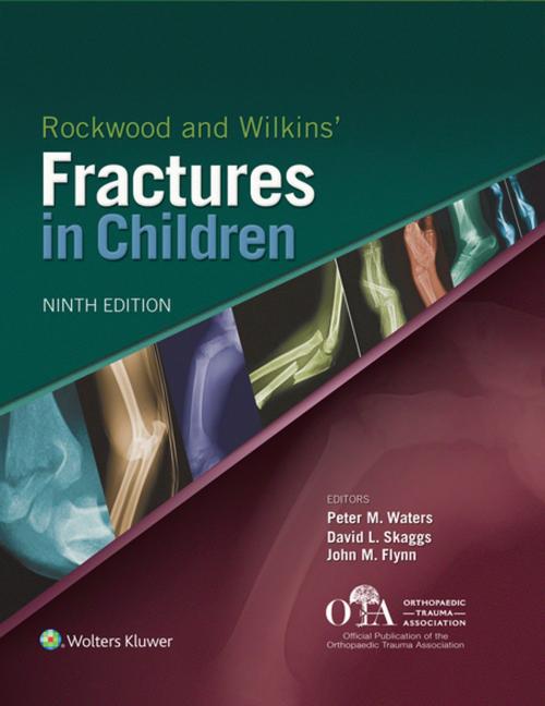 Cover of the book Rockwood and Wilkins Fractures in Children by Peter M. Waters, David L. Skaggs, John M. Flynn, Wolters Kluwer Health