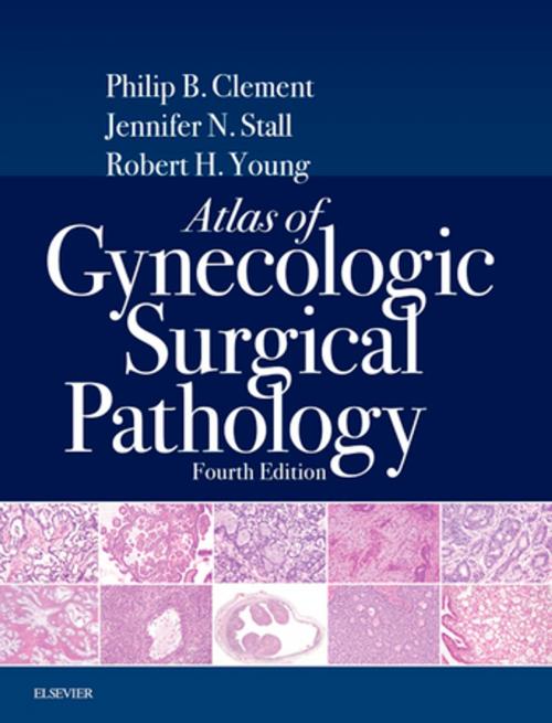 Cover of the book Atlas of Gynecologic Surgical Pathology E-Book by Philip B. Clement, MD, Robert H. Young, MD, FRCPath, Jennifer Stall, MD, Elsevier Health Sciences