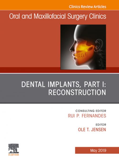 Cover of the book Dental Implants, Part I: Reconstruction, An Issue of Oral and Maxillofacial Surgery Clinics of North America, Ebook by Ole Jensen, DDS, MS, Elsevier Health Sciences