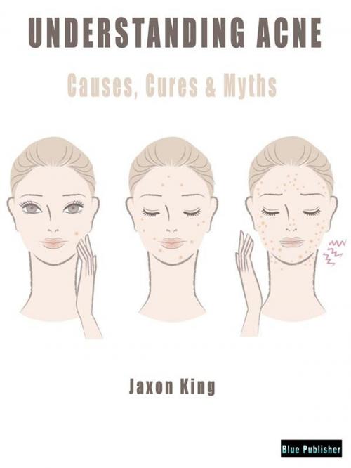 Cover of the book Understanding Acne by Jaxon King, Blu Editore